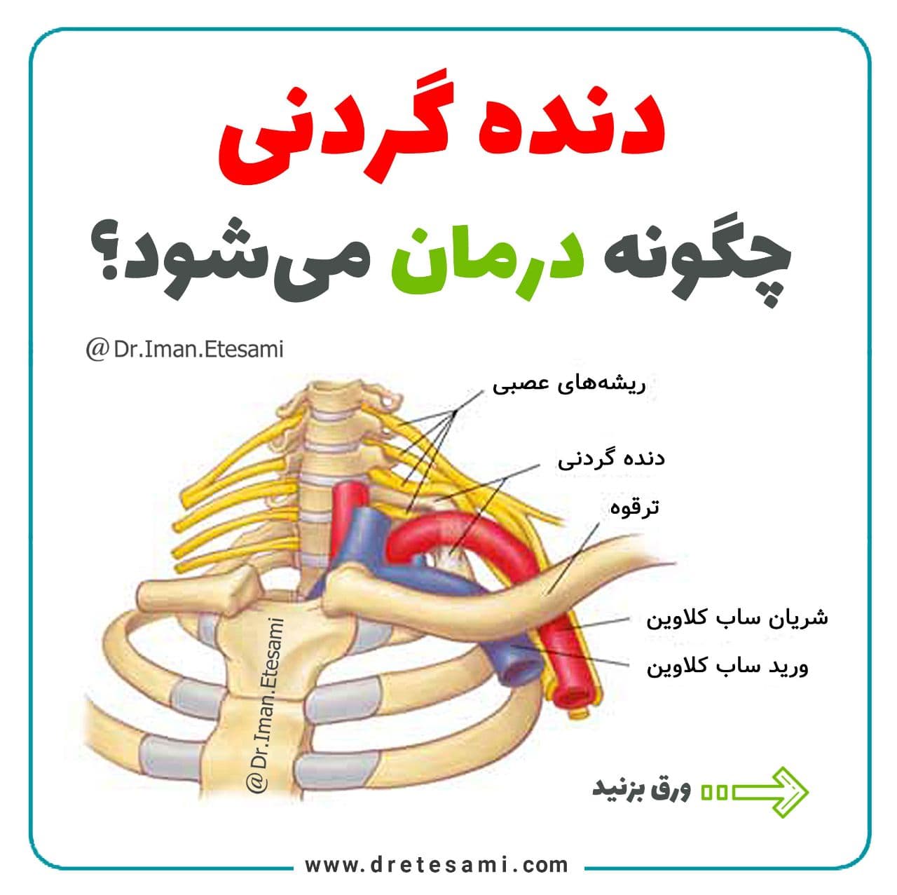 دنده گردنی چگونه درمان می‌شود؟